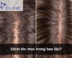 10cm tóc mọc trong bao lâu?