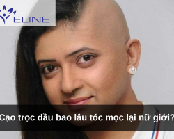 Cạo trọc đầu bao lâu tóc mọc lại nữ giới?