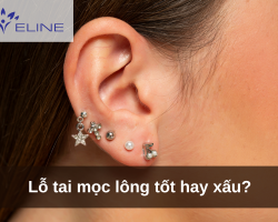 Lỗ tai mọc lông tốt hay xấu?