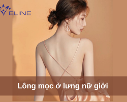 Lông mọc ở lưng nữ giới 
