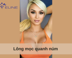 Lông mọc quanh núm 