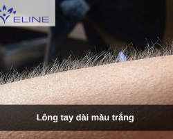 Lông tay dài màu trắng 