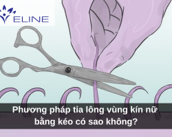 Phương pháp tỉa lông vùng kín nữ bằng kéo có sao không?