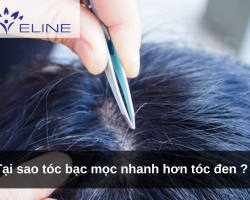 Tại sao tóc bạc mọc nhanh hơn tóc đen ?