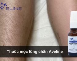 Thuốc mọc lông chân Aveline