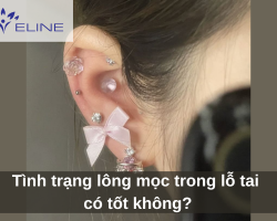 Tình trạng lông mọc trong lỗ tai có tốt không?