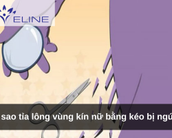 Vì sao tỉa lông vùng kín nữ bằng kéo bị ngứa? 