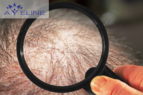 Đối tượng sử dụng dầu gội ngăn rụng tóc và kích thích mọc tóc