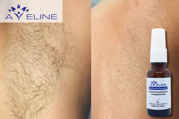 Ai nên dùng thuốc mọc lông nách Aveline?