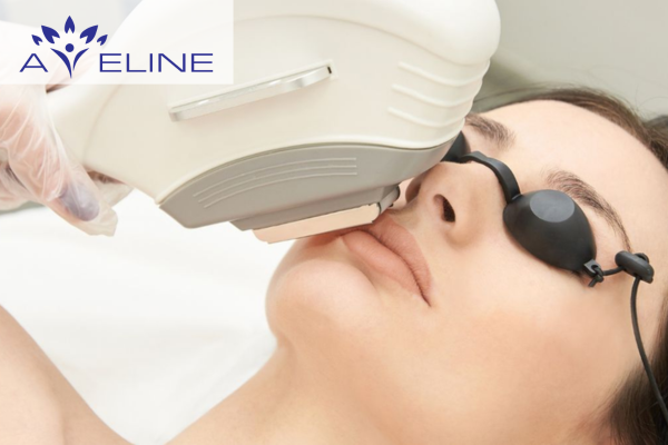 Các phương pháp triệt lông