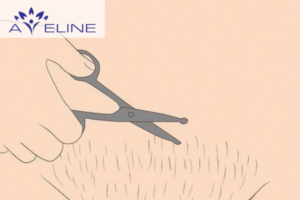 Dấu hiệu khi bị ngứa sau khi tỉa lông 