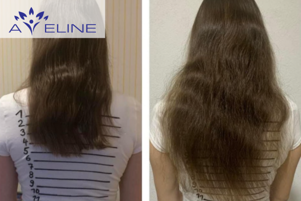 Khả năng phát triển tự nhiên của tóc là bao nhiêu?