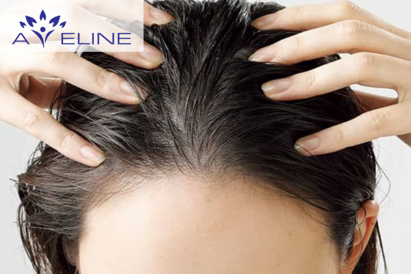 Làm sao để tóc mọc lại nhanh và khỏe hơn?