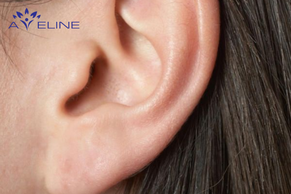 Lông mọc ở tai là gì?