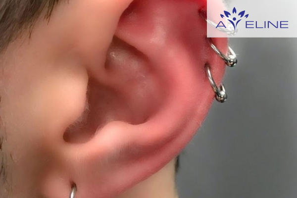 Lông mọc ở vành tai trái có ý nghĩa gì?