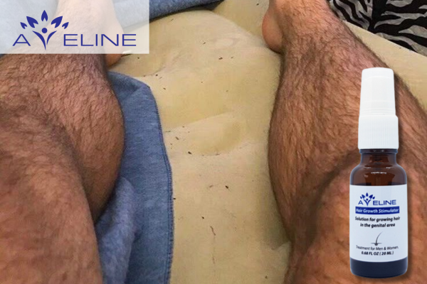 Lưu ý khi sử dụng thuốc mọc lông chân