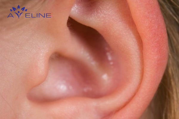 Nguyên nhân lông mọc ở vành tai trái