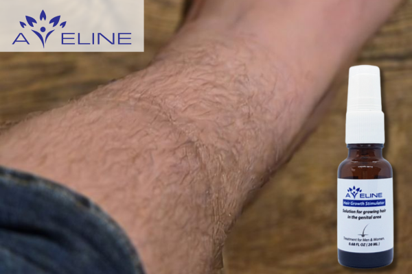 Thuốc mọc lông chân Aveline là gì?