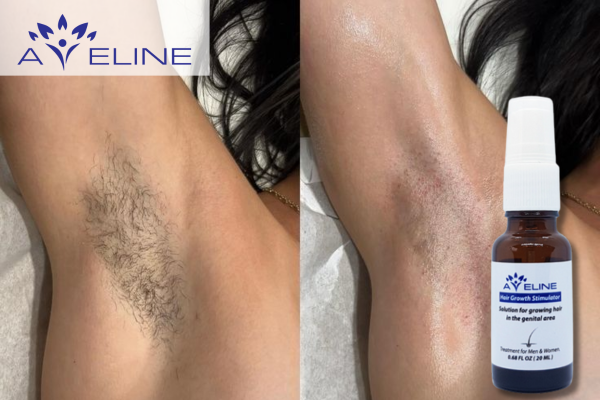 Thuốc mọc lông nách Aveline