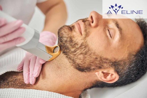 Triệt lông bằng laser