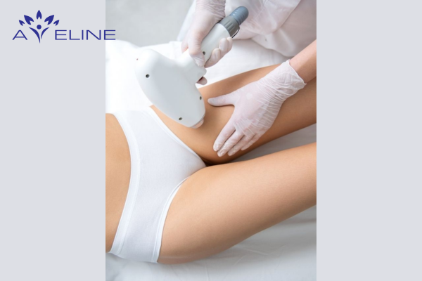 Triệt lông bằng laser