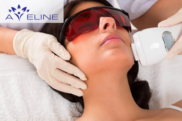 Triệt lông mặt có tác hại