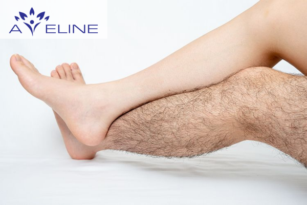 Vì sao nhiều nam giới ít hoặc không có lông chân?